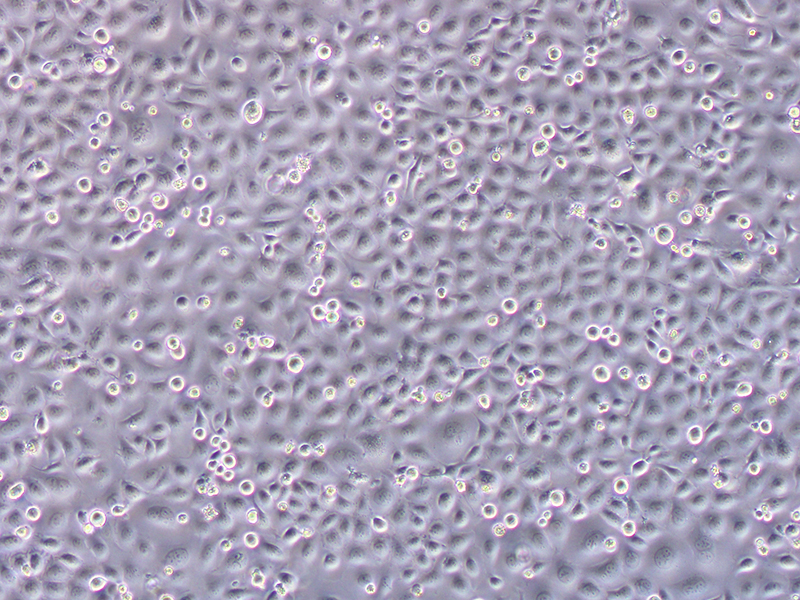 M619（人侵袭性脉络膜黑色素瘤细胞）