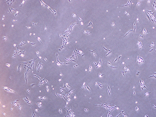 Human retinal pericyte